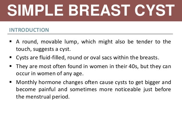 movable lumps in breast Monique van de ven nude
